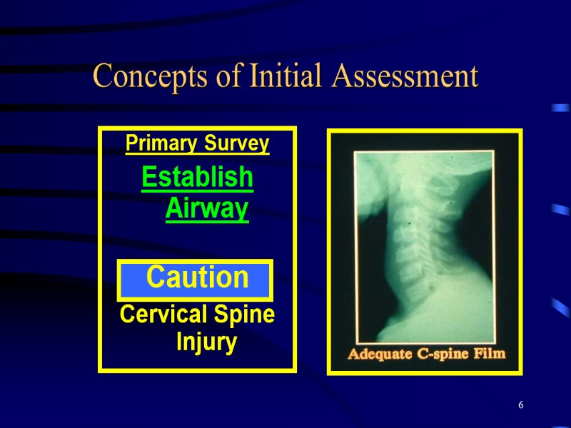 6 Concepts of Initial Assessment Primary Survey Establish Airway  Caution Cervical Spine Injury